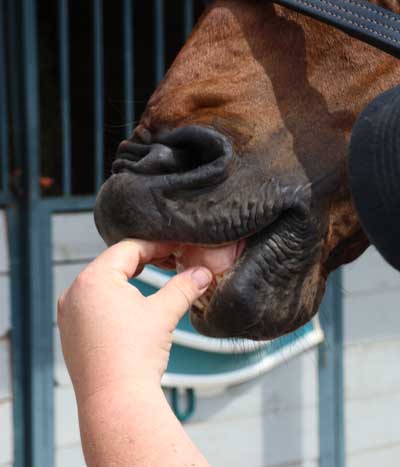 Capillary Refill Time for Dehydration Check